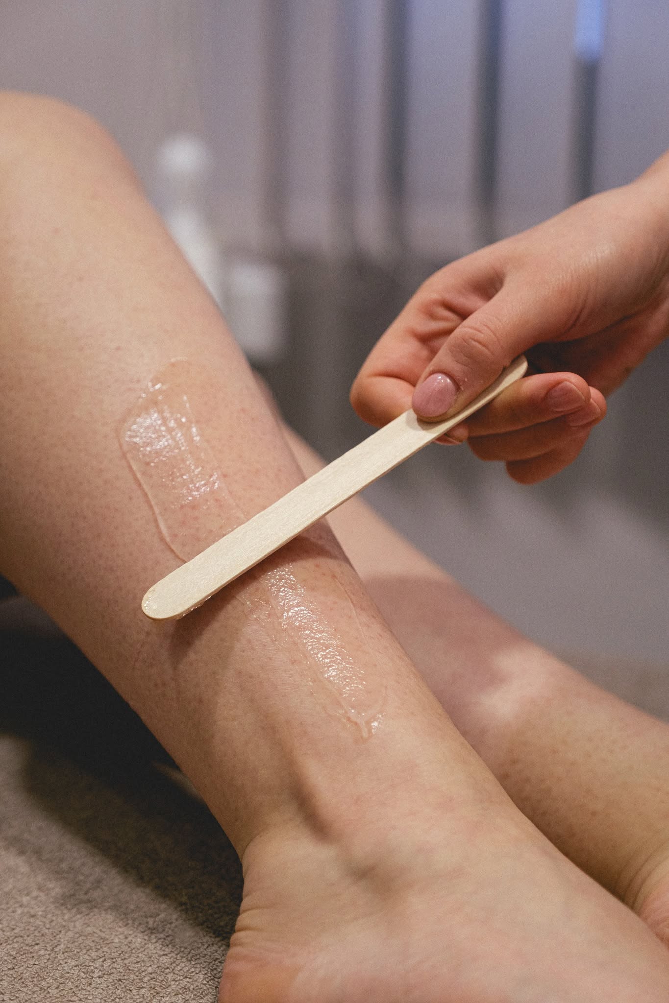 Applicazione del gel sulla gamba con spatola durante il trattamento